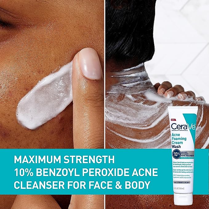 Cerave Acne Foaming Cream Wash Cleanser 10% Benzoyl Peroxide