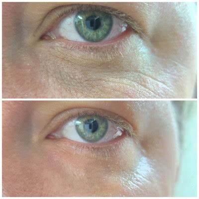 CeraVe Eye Repair Cream
