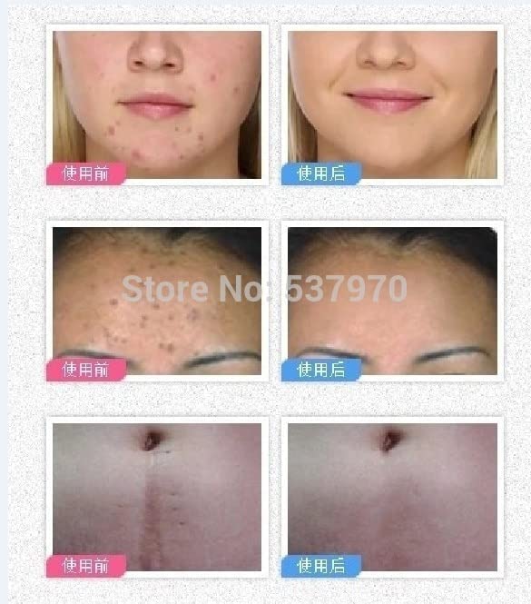 Bepanthen Moisturizing Cream