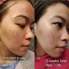 CeraVe SA Cleanser