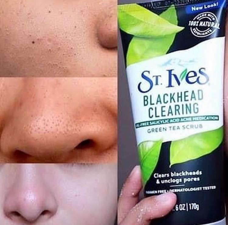 St. Ives Blackhead Clearing Green Tea Scrub